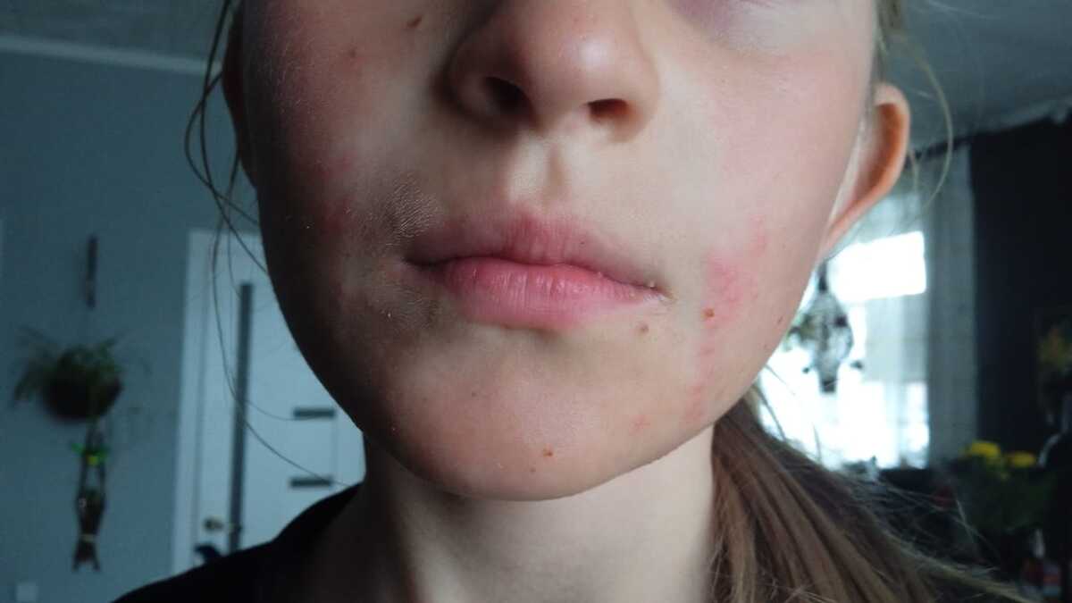 В одном из райцентров ВКО детские площадки соседствуют с опасными растениями